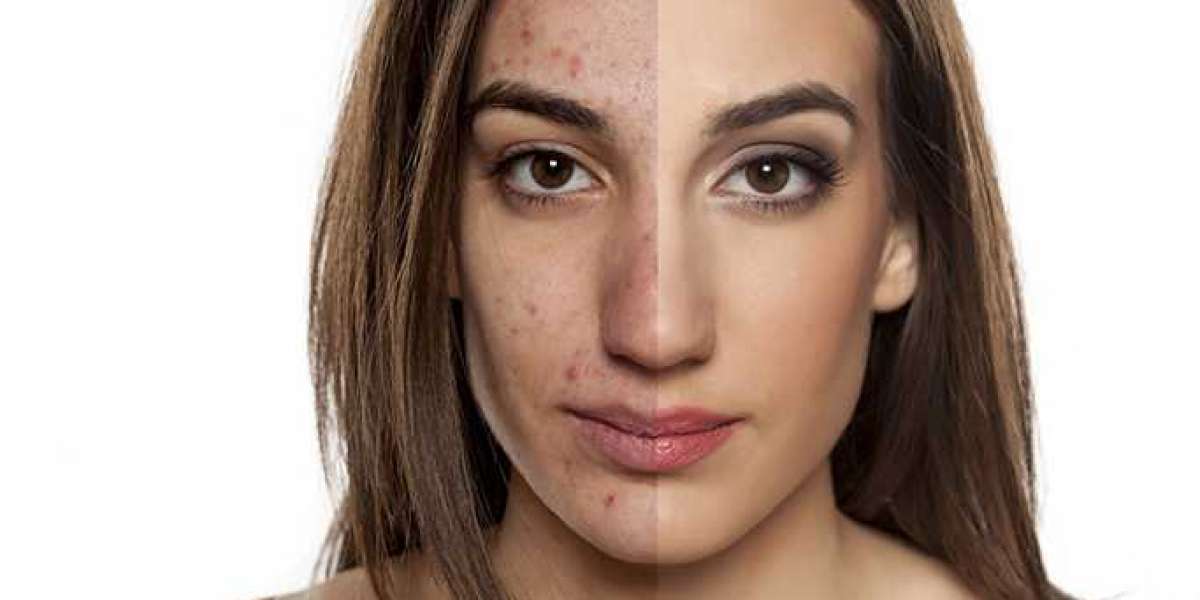 Improve Your Skin's Radiance Without Any Negative Side Effects