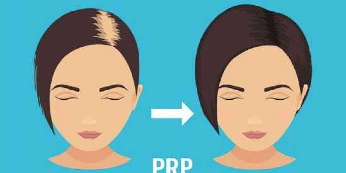 Prp hair treatment
