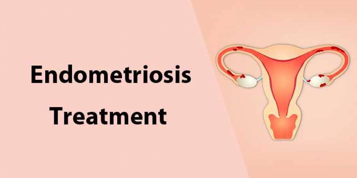 Endometriosis treatment in Mumbai - Dr. Chaitali Mahajan Trivedi