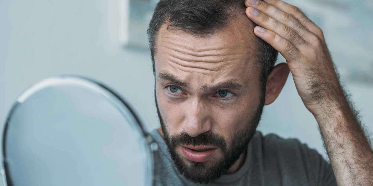 Get The Best Treatment For Baldness With Hair Transplant