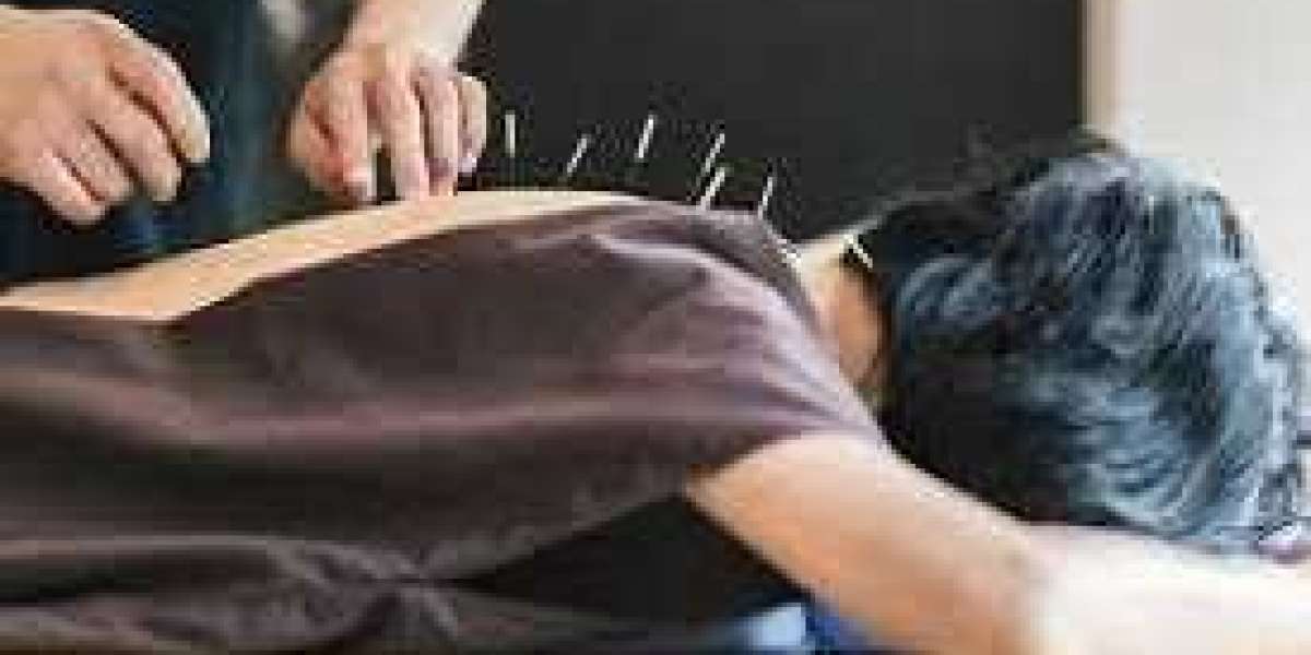 What follows after an acupuncture treatment?