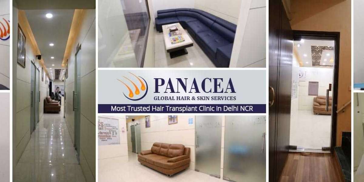 Best Hair Transplant in New Delhi