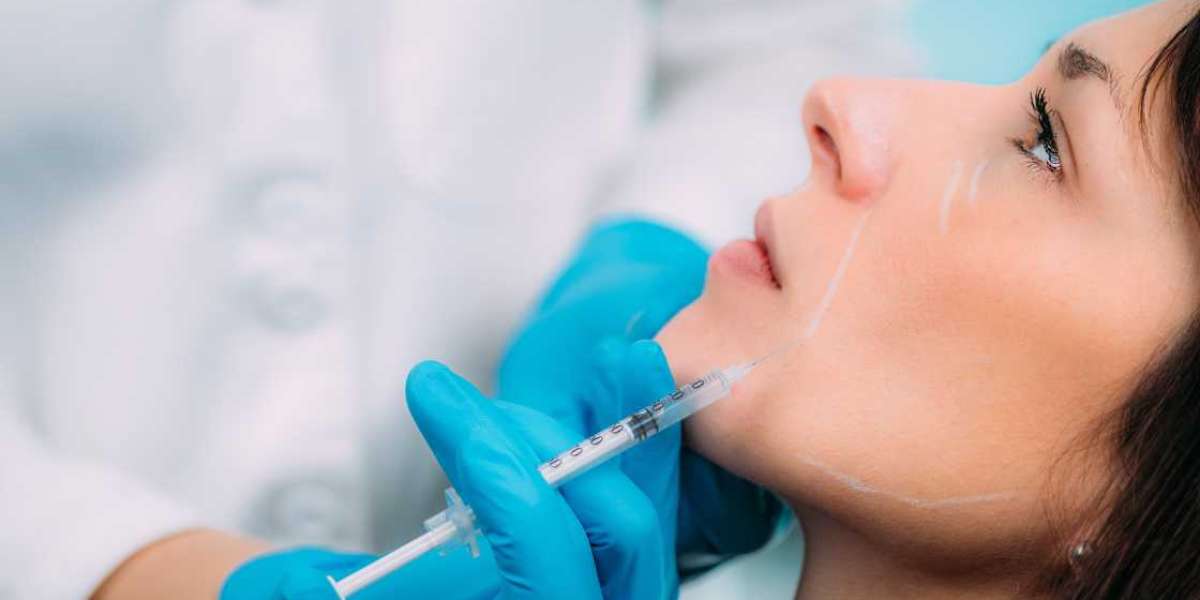 What are the Benefits of Undergoing Dermal Filler Treatment?