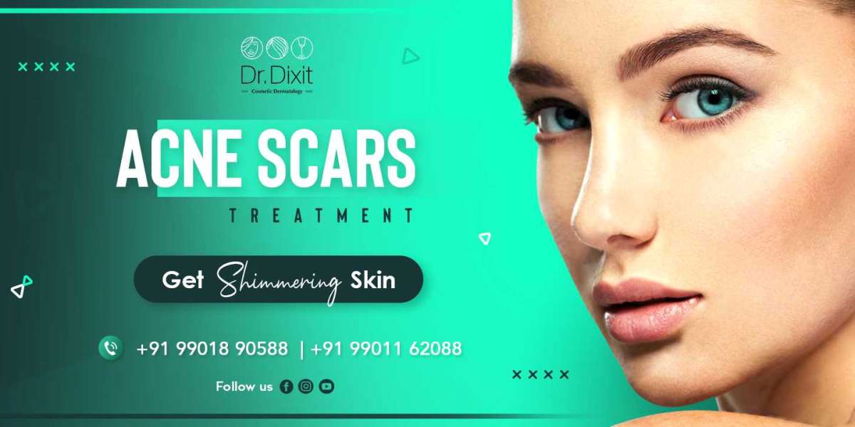 Consult the Best Skin Specialist in Koramangala