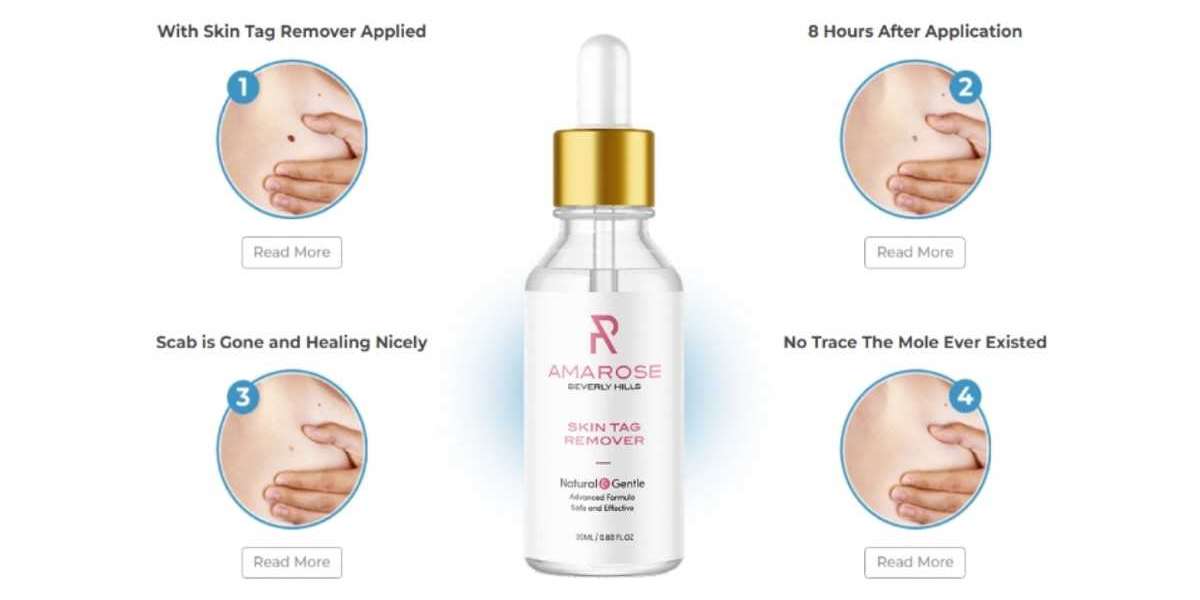 What Is Paradise Skin Tag Remover, Anyway?