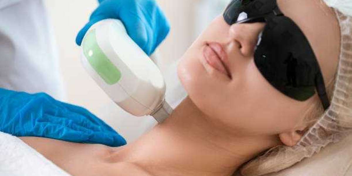 Get Laser-Targeted Results with Sunshine Coast's Best Laser Hair Removal