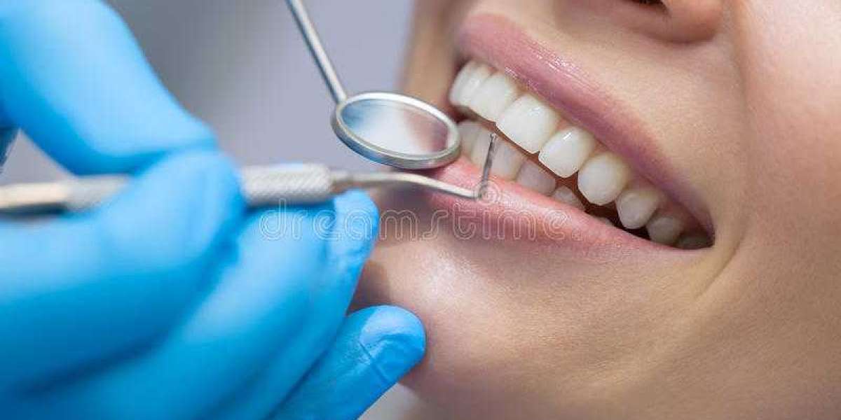 Best Dentist in Delhi: Get the Smile of Your Dreams