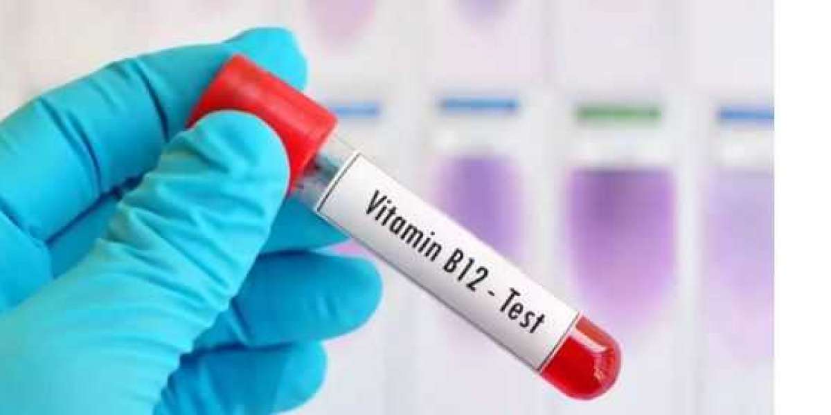 Book A Vitamin B12 Test in Pune for Nutritional Assessment