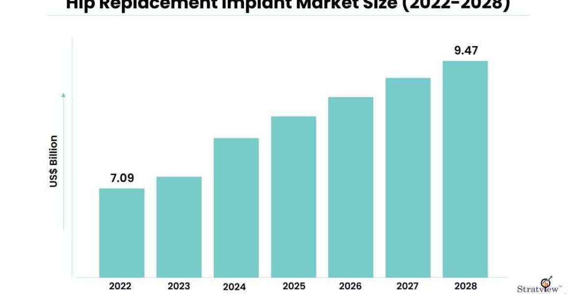 Technological Advancements in Hip Replacement Implants: Revolutionizing Patient Outcomes