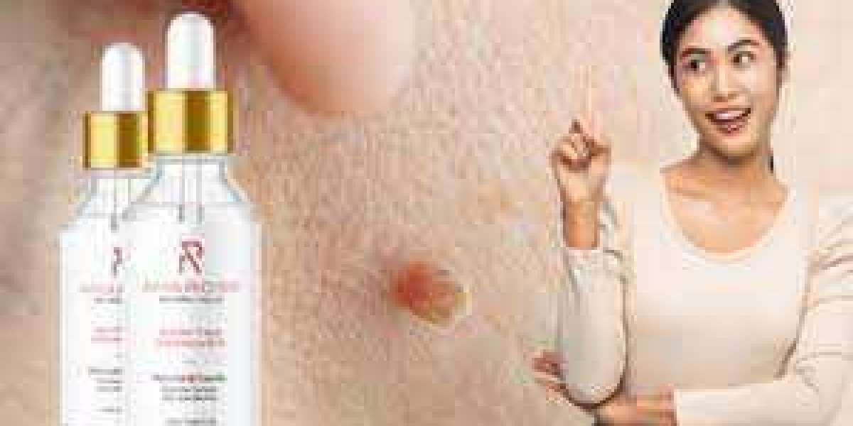 The Anatomy of a Great Amarose Skin Tag Remover