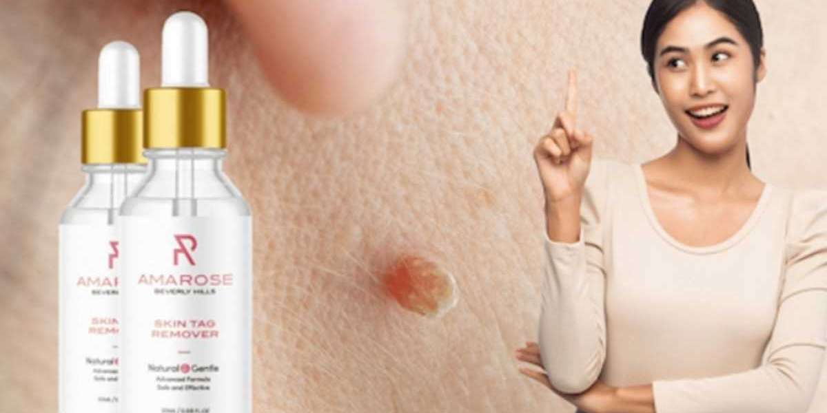 What Are the Benefits of Using a Amarose Skin Tag Remover?