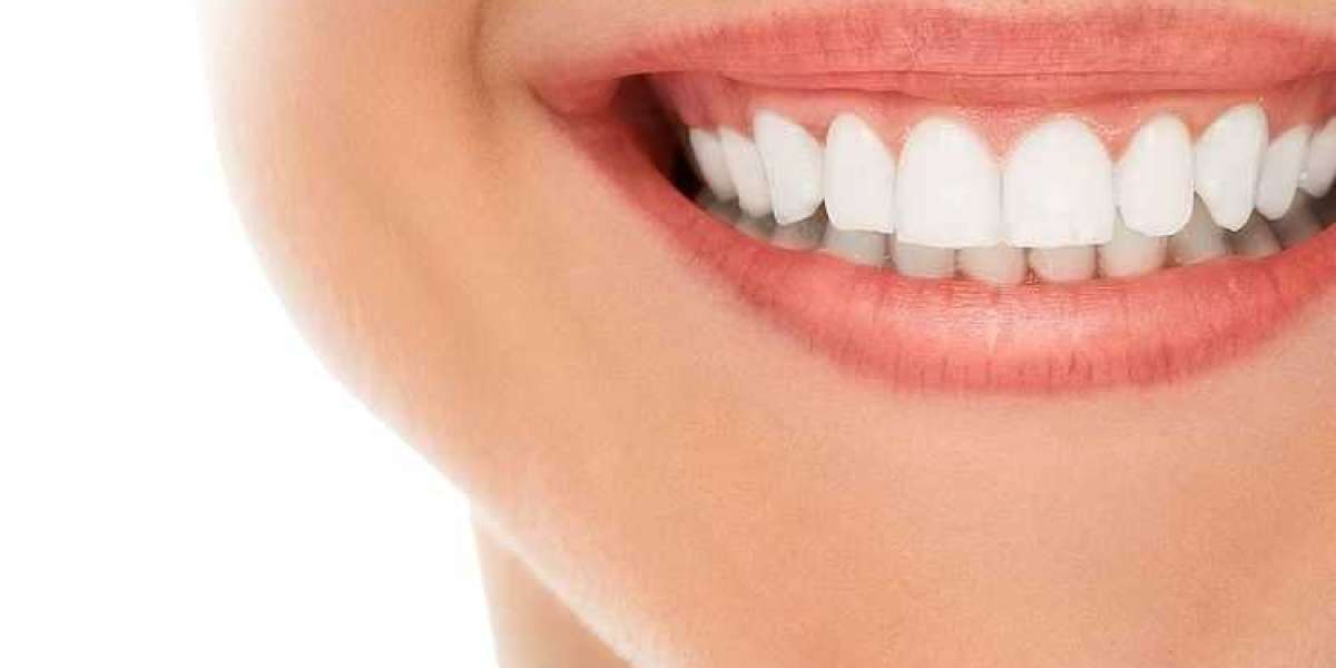 The Importance Of Regular Dental Check-Ups And Cleaning