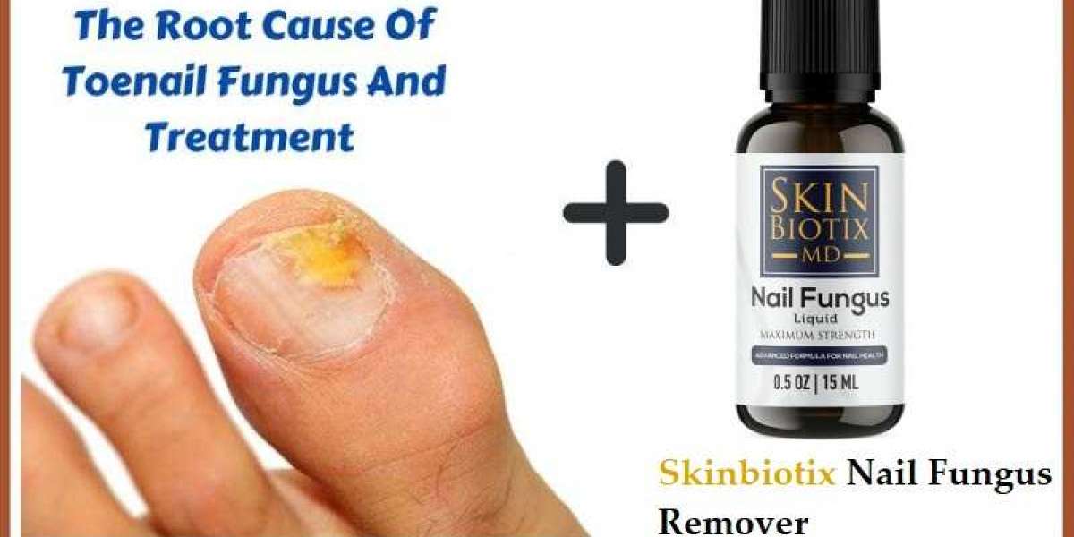 Skinbiotix Nail Fungus Remover Reviews: Toenail Fungus Oil Results & Price!