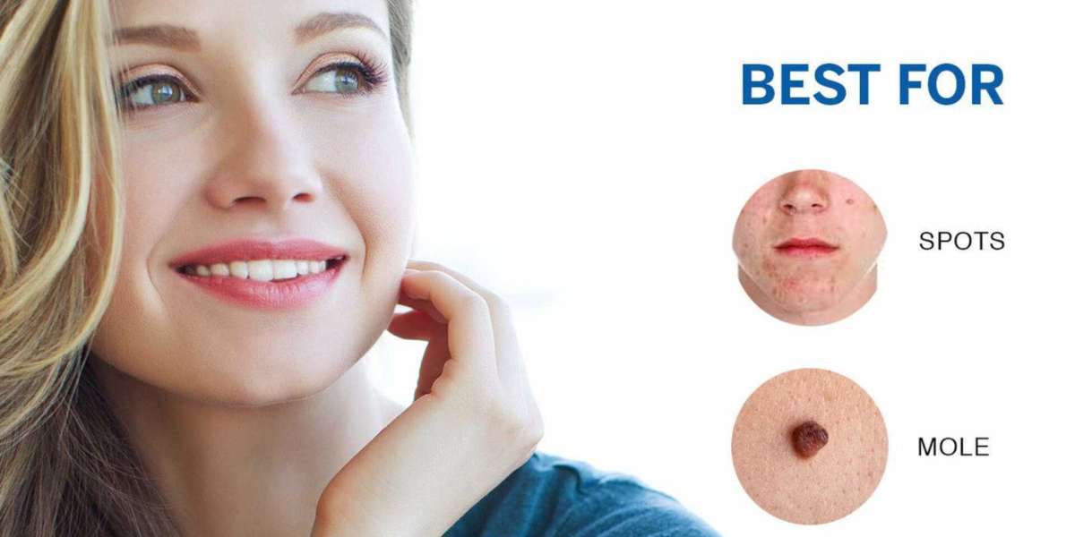 How Do Skin Biotix Skin Tag Remover Truly Work On Skin?