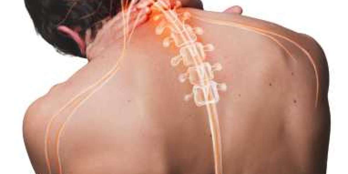Need Neck Pain Treatment That Works?