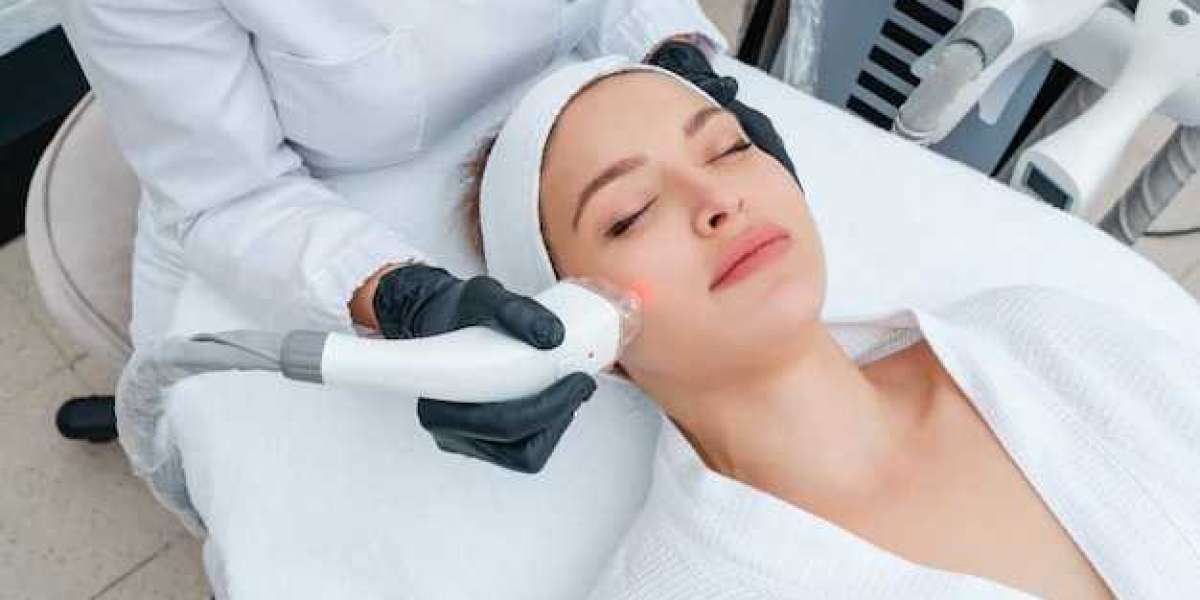Laser Hair Removal: Embrace a Hair-Free Lifestyle in Vancouver
