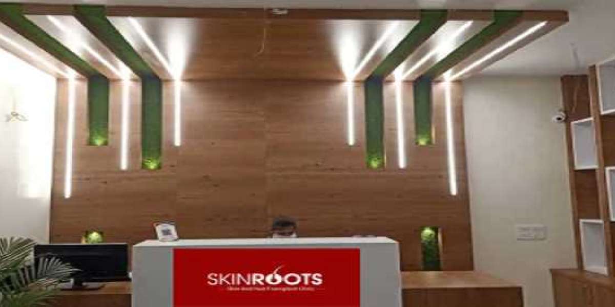 Affordable Hair Transplant Cost in Delhi - Skinroots Clinic