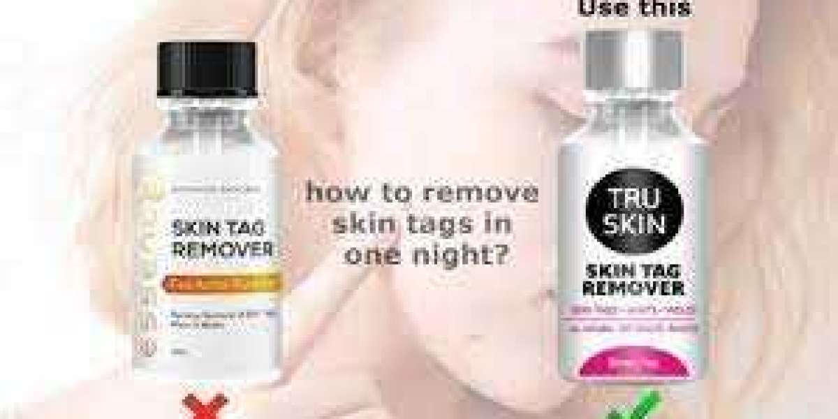 14 Shocking Kanye West Tweets About Tru Skin Tag Remover Review