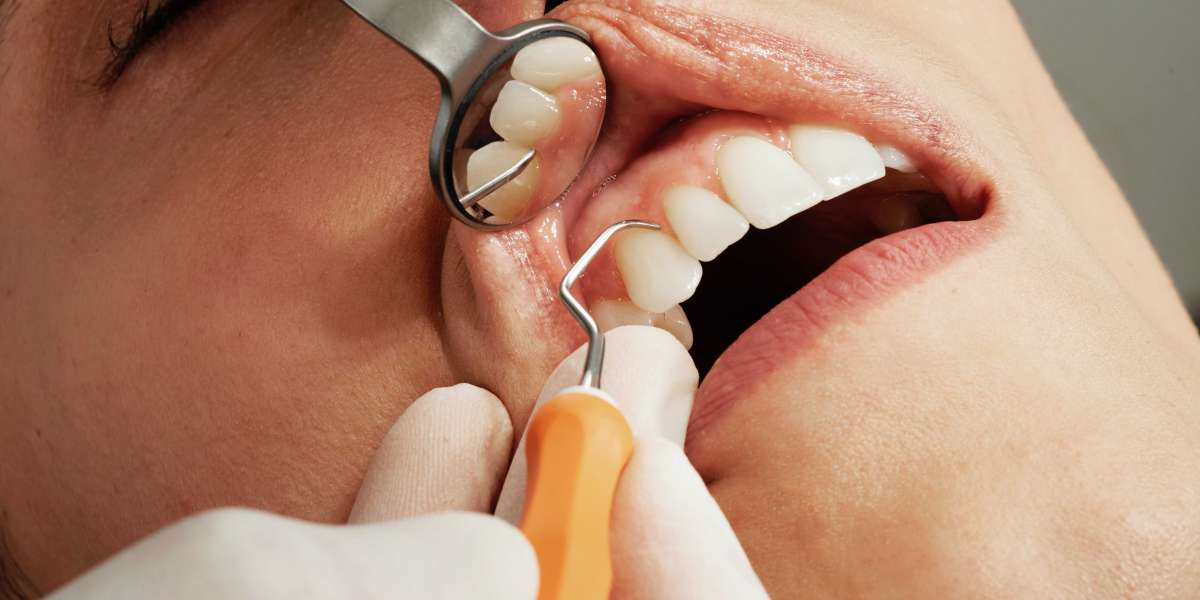 Emergency Dentistry: The Role and Importance of Composite Bonding