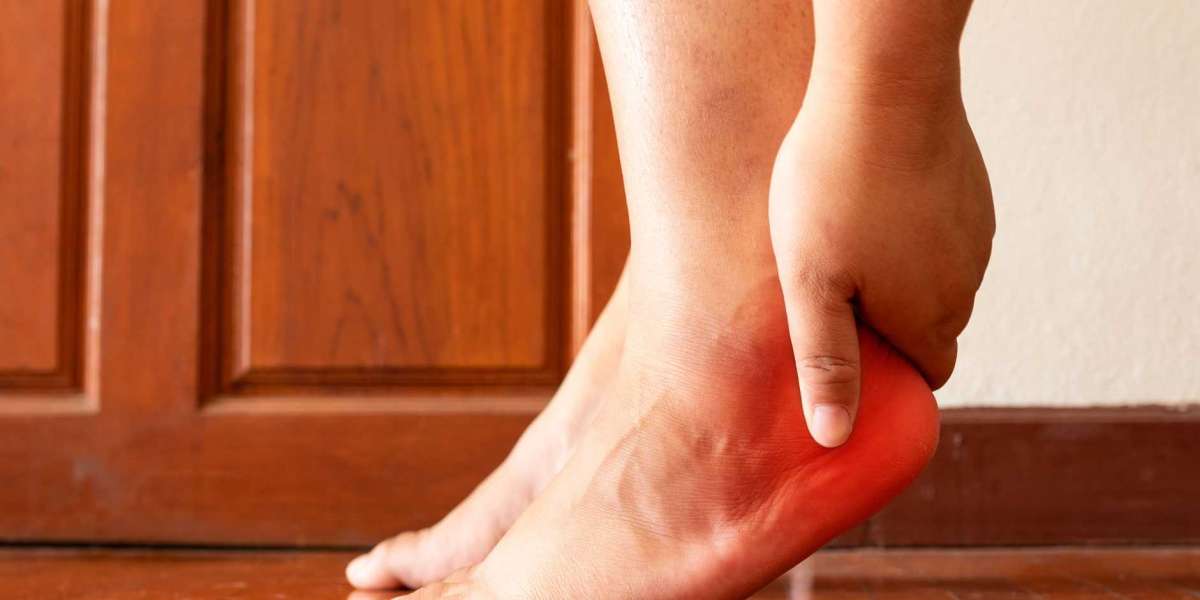 Effective Physiotherapy Strategies for Managing Plantar Fasciitis