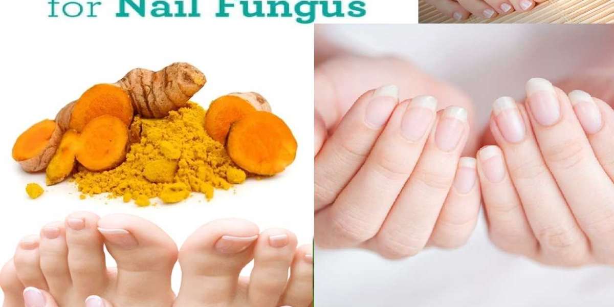 Kill Nail Fungus Natural Remedy Way to Improve Your Nails!