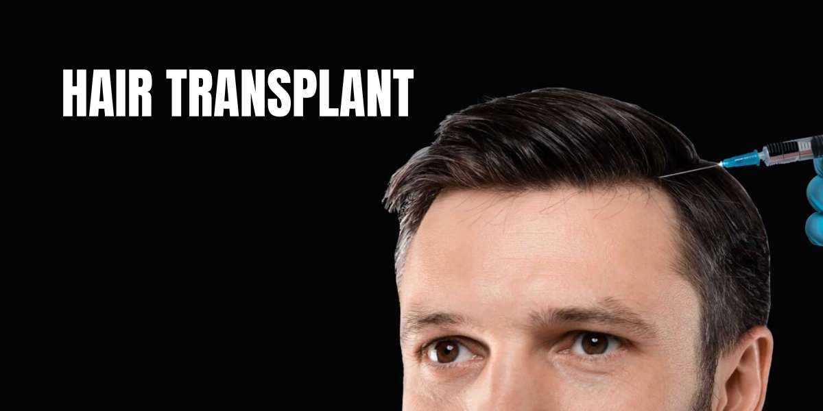 Hair Transplantation In Winter- A Guide By Dermatologist