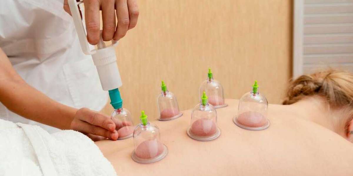 How Cupping Therapy in Las Vegas Help with Chronic Pain