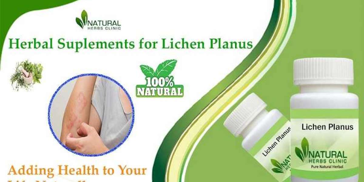 Lichen Planus Treatment at Home: Safe and Natural Remedies That Work!