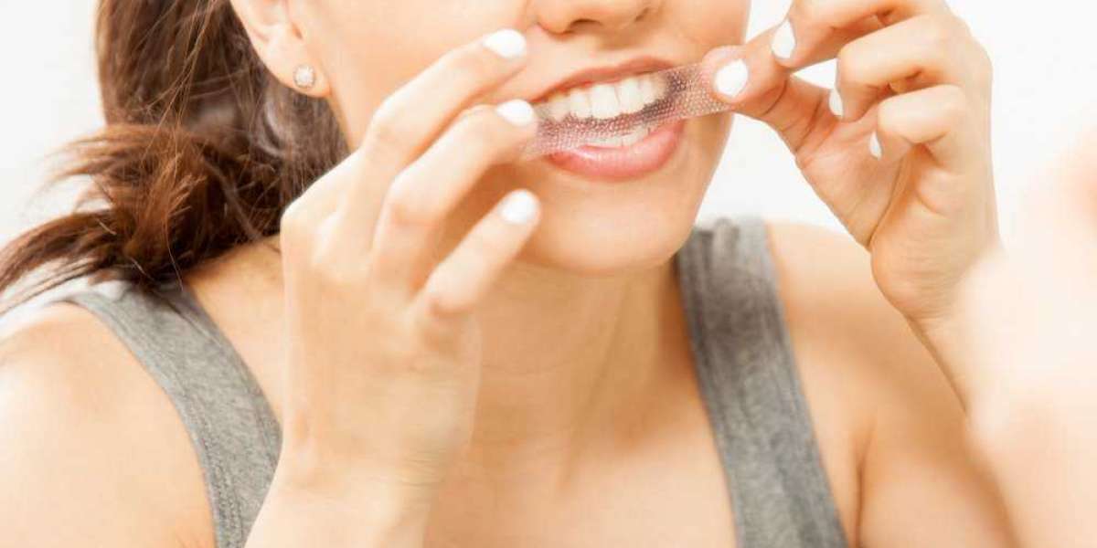 Maximising Your Results: Tips for Using Crest Strips Teeth Whitening Effectively