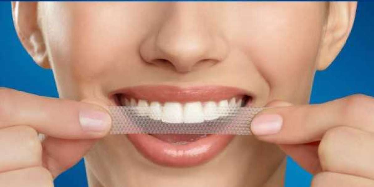 Say Goodbye to Stains with the Best Teeth Whitening Strips UK