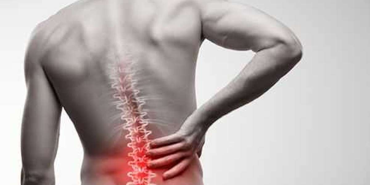 Effective Back Pain Treatment: Find Relief with the Best Experts in Delhi