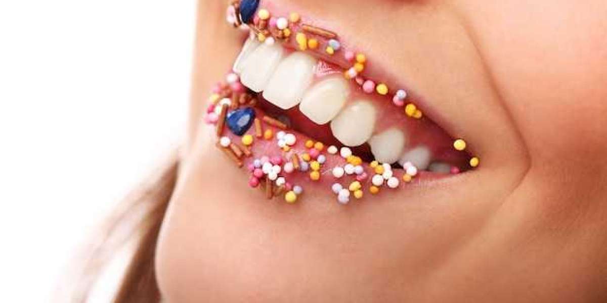 The Best Teeth Whitening Services in Denver: A Guide to Getting That Bright Smile