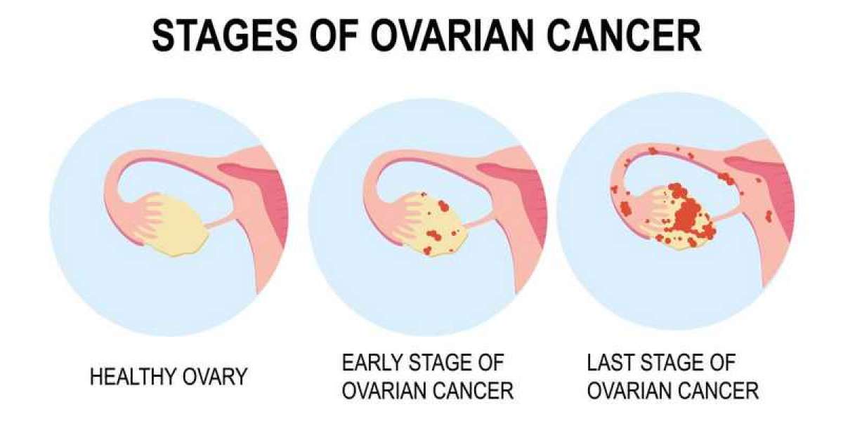 cancer